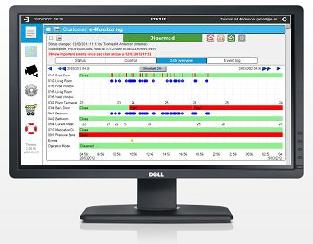 Alzheimer Dementia activities of daily living